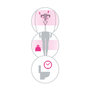 Pelvic Vein Embolisation