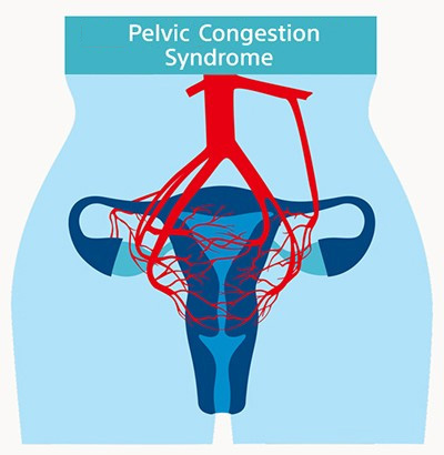 graph image